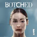 Botched, Season 4 cast, spoilers, episodes and reviews