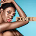 Botched, Season 2 watch, hd download