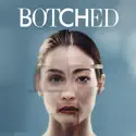 Botched, Season 3 watch, hd download